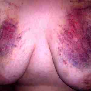 Wtf Pics of me Bbw
