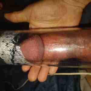 Size matters ASIAN CURSE IS TREATABLE, BUT CANT BE CURED. EXCEPT WITH STIMULATION.  FROM Nubby to Chubby. Don't have a hard