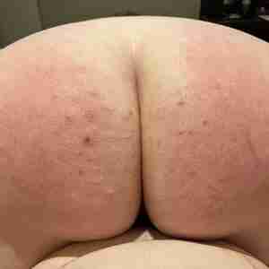 my past experiences mostly just my ass being red or bruised lol ass bruised spanks