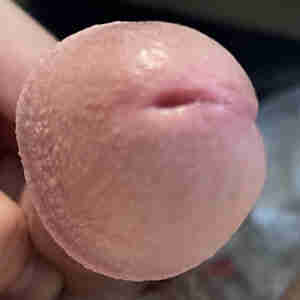 A Hole in my Head A hole in the head of my cock. hole, head cock dick