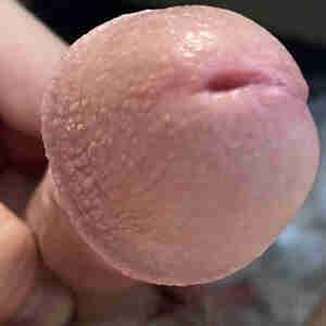 A Hole in my Head A hole in the head of my cock. hole, head cock dick
