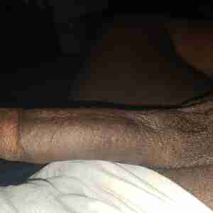 Me 7 inches Anal sex lover