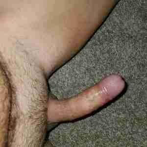 Pics Cock pics Hard cock
