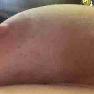 Moobs MOOBS APLENTY MOOBS aka Man boobs