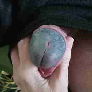 My cumstick Buttonhole Foreskin Pierced