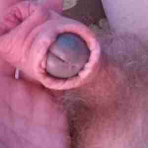 My cumstick Buttonhole Foreskin Pierced