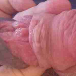 My cock Foreskin has a buttonhole piercing. The hole allows me to expose the glans or keep it covered. It is tattooed that