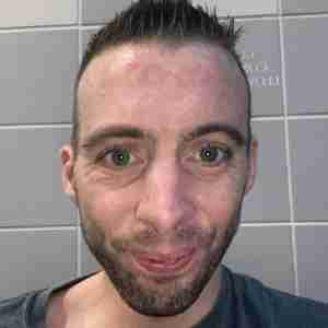 I’m single girls I’m being straightforward to u girls I have mild autism and anxiety in also speech disorder too. But I