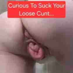 Women with Prolapse