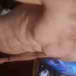 medy2666