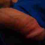 bgdick