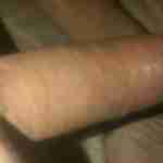 kinecis