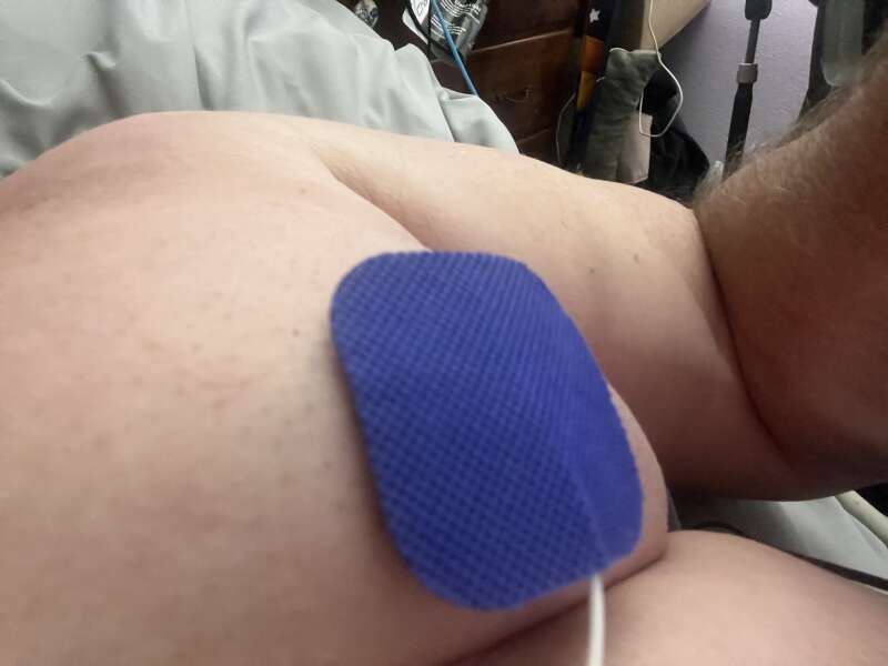 Moobs electrical stimulation torture